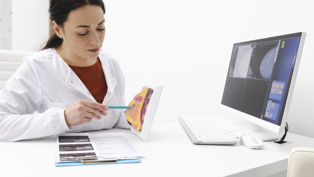 Inovacije u terapijama za rak dojke i prevencija bolesti