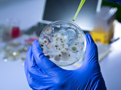 Virus „supergripa“ registrovan i u Rumuniji