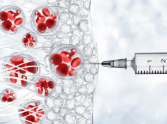 Nanočestice kao „rezervne baterije“ podmlađuju stare i oštećene ćelije
