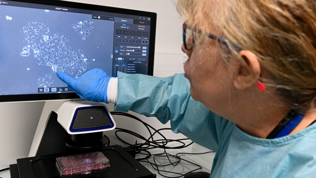 Veliki pomak u borbi protiv raka pankreasa