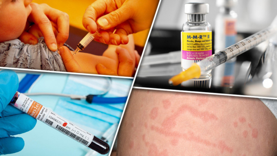 Male boginje i dalje problem širom Evrope