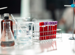 Prisustvo olova u krvi pronađeno kod još 100 testiranih osoba