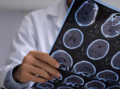 Mozak može da zadrži određeni stepen svesti satima nakon smrti