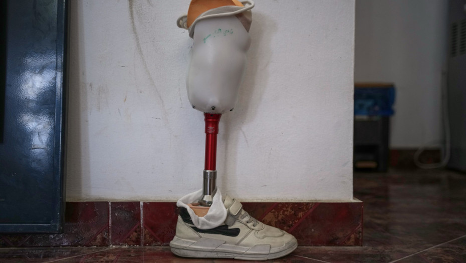 Sam napravio protezu za nogu, uštedeo više od 40.000 evra