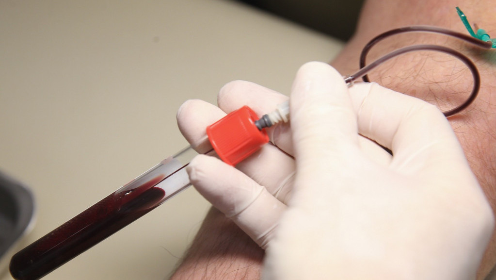 Najbrža rastuća HIV epidemija na svetu