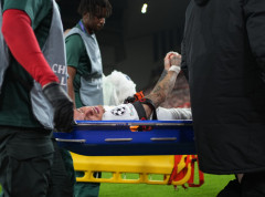 Osimen doživeo prelom desne podlaktice, Lang ima ozbiljnu posekotinu