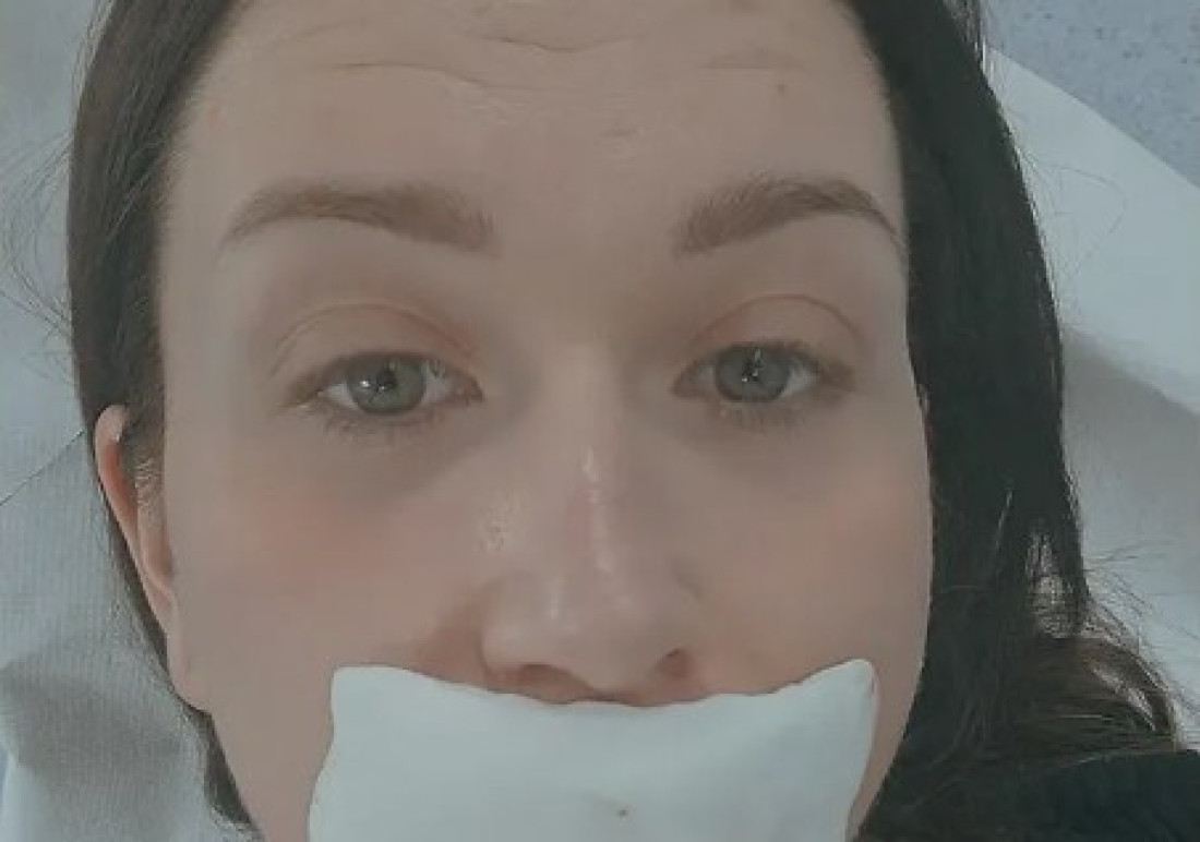 Pevačica izvadila silikone iz usana