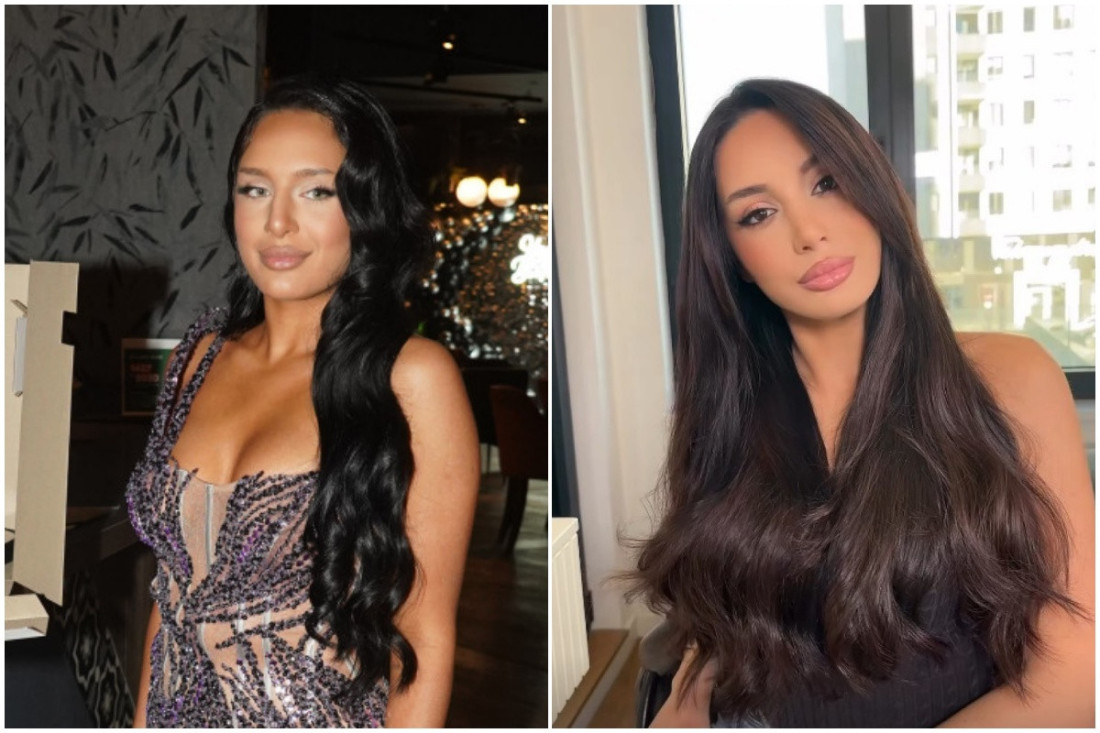 Nina Đogani pre i posle estetskih intervencija