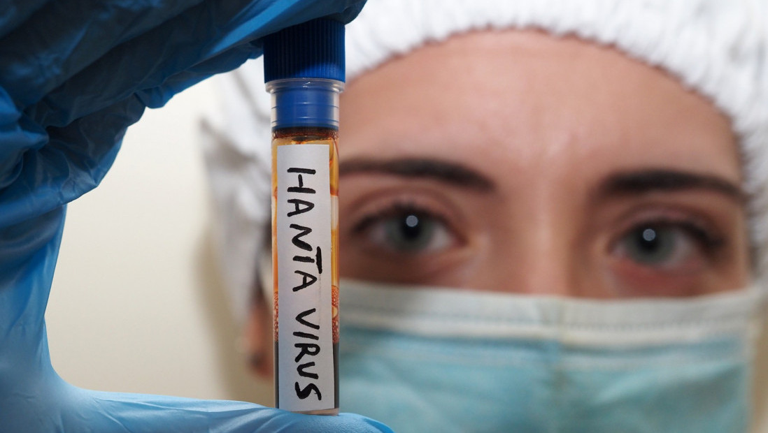 Nema opasnosti od hantavirusa, tvrdi epidemiolog