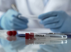 Dva muškarca u Brazilu na ispitivanju zbog sumnje da su zaraženi ebolom
