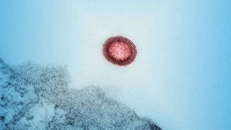 Svetu preti ponovno širenje epidemije HIV-a