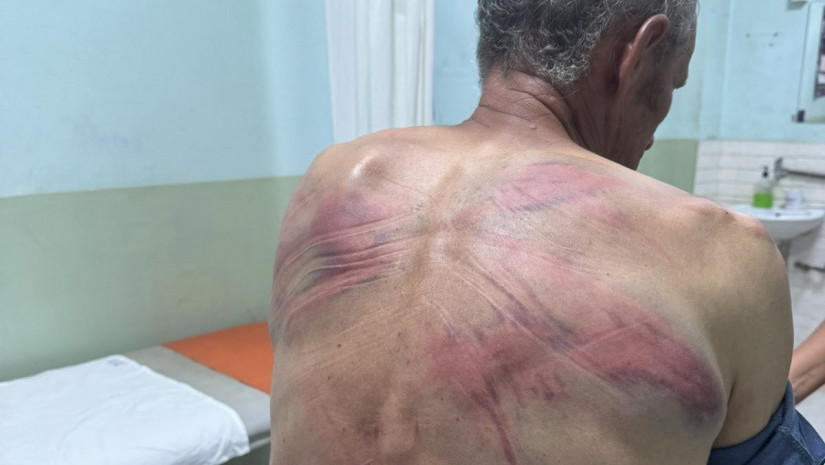 Srbina vezali za drvo i tukli u šumi